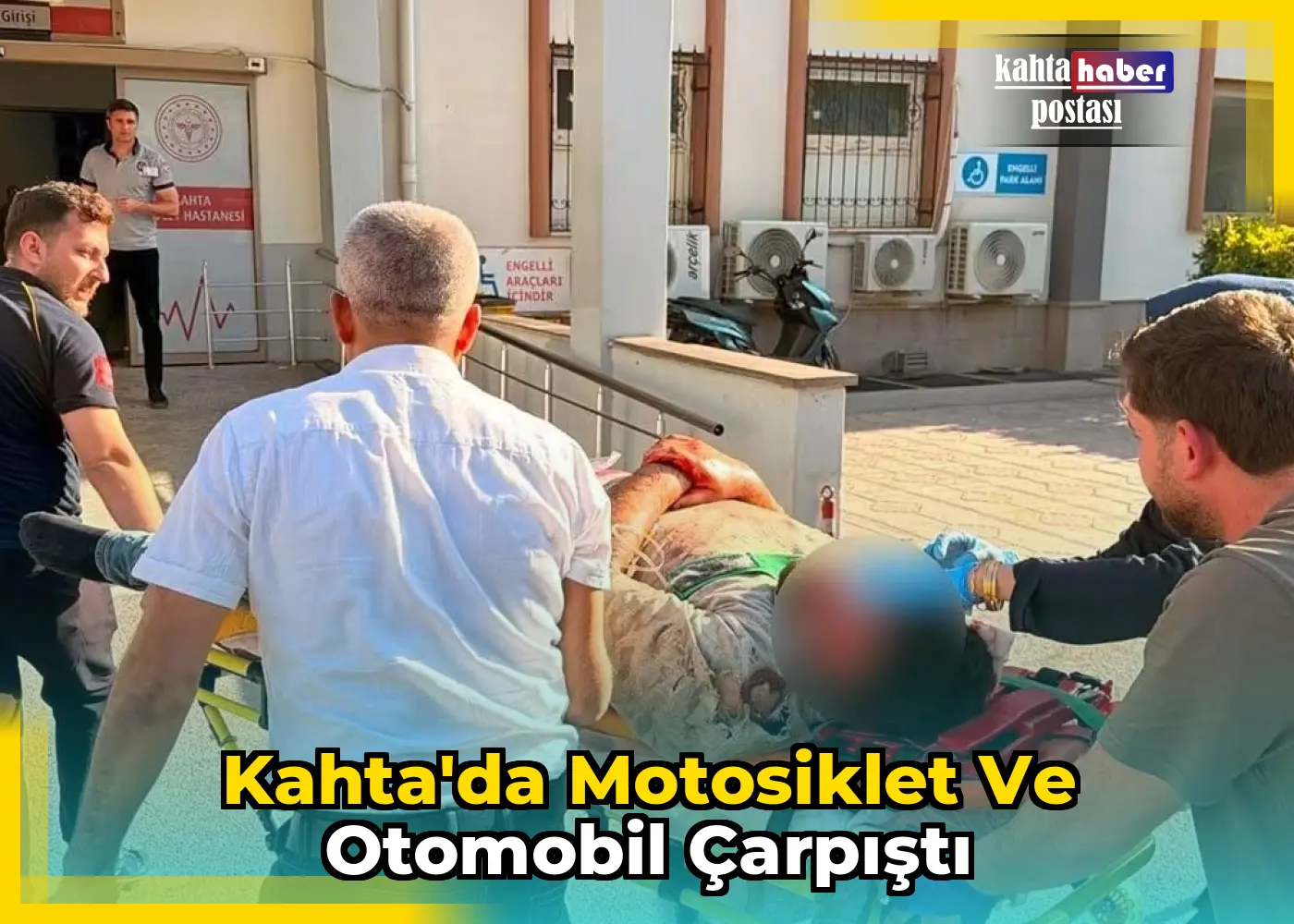 Kahta'da Motosiklet ve Otomobil Çarpıştı