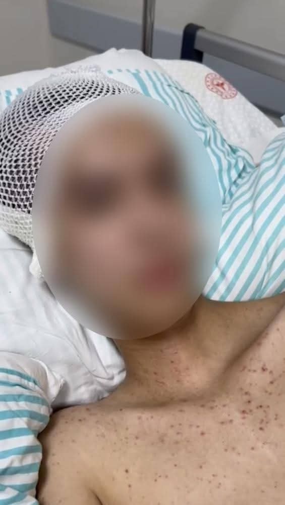 Silahla İntihar Etti Denildi; Gerçek Komadan Çıkınca Anlaşıldı