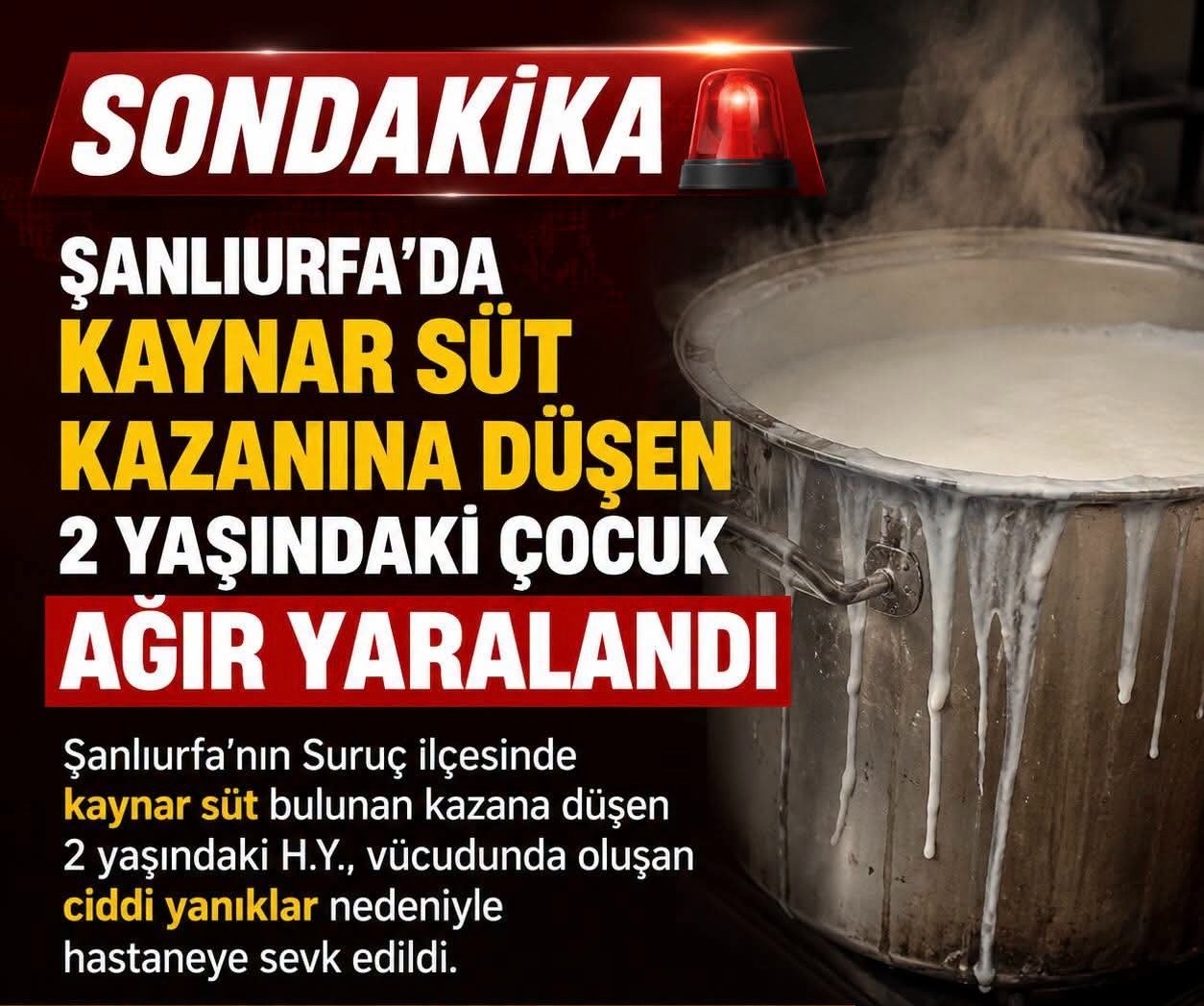 Şanlıurfa'da Kaynar Süte Düşen Çocuk Ağır Yaralandı